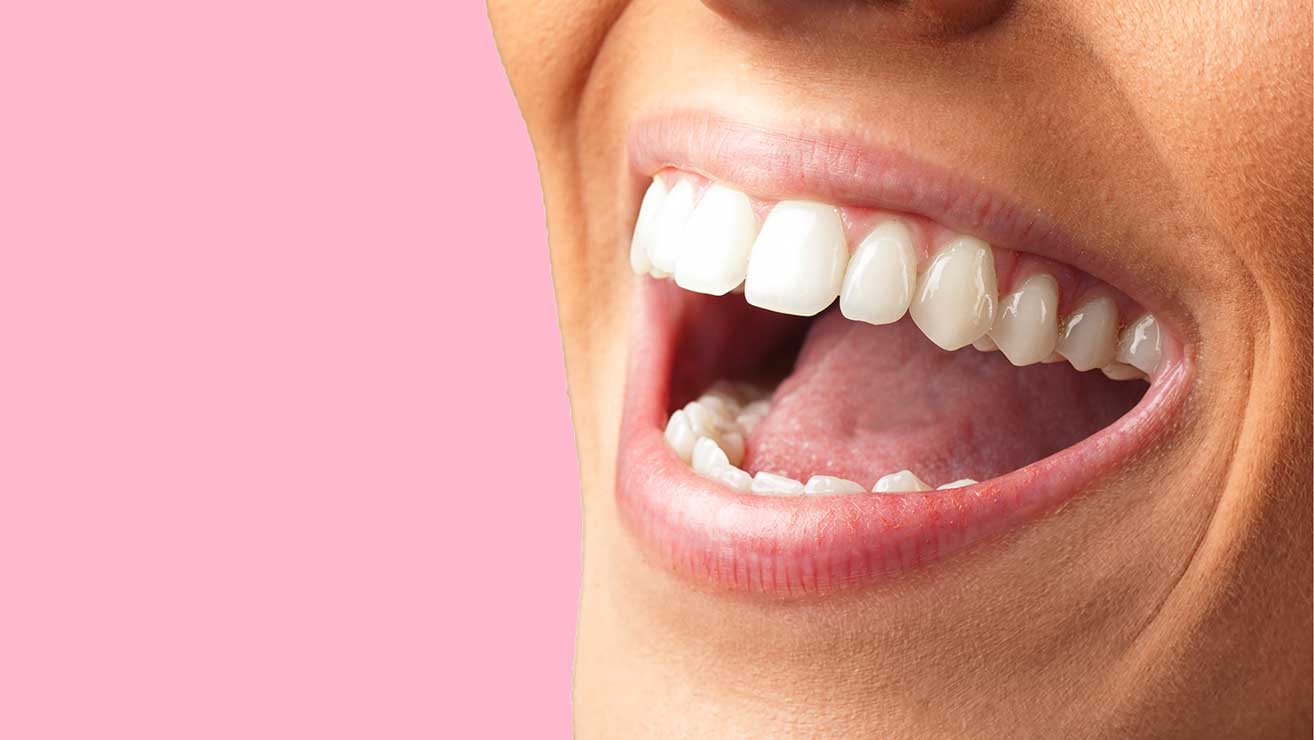 Tökéletes mosolygó női fogsor rózsaszín háttér előtt